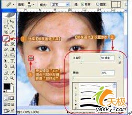 妙用PS快速去痘痘斑点之秘决教程